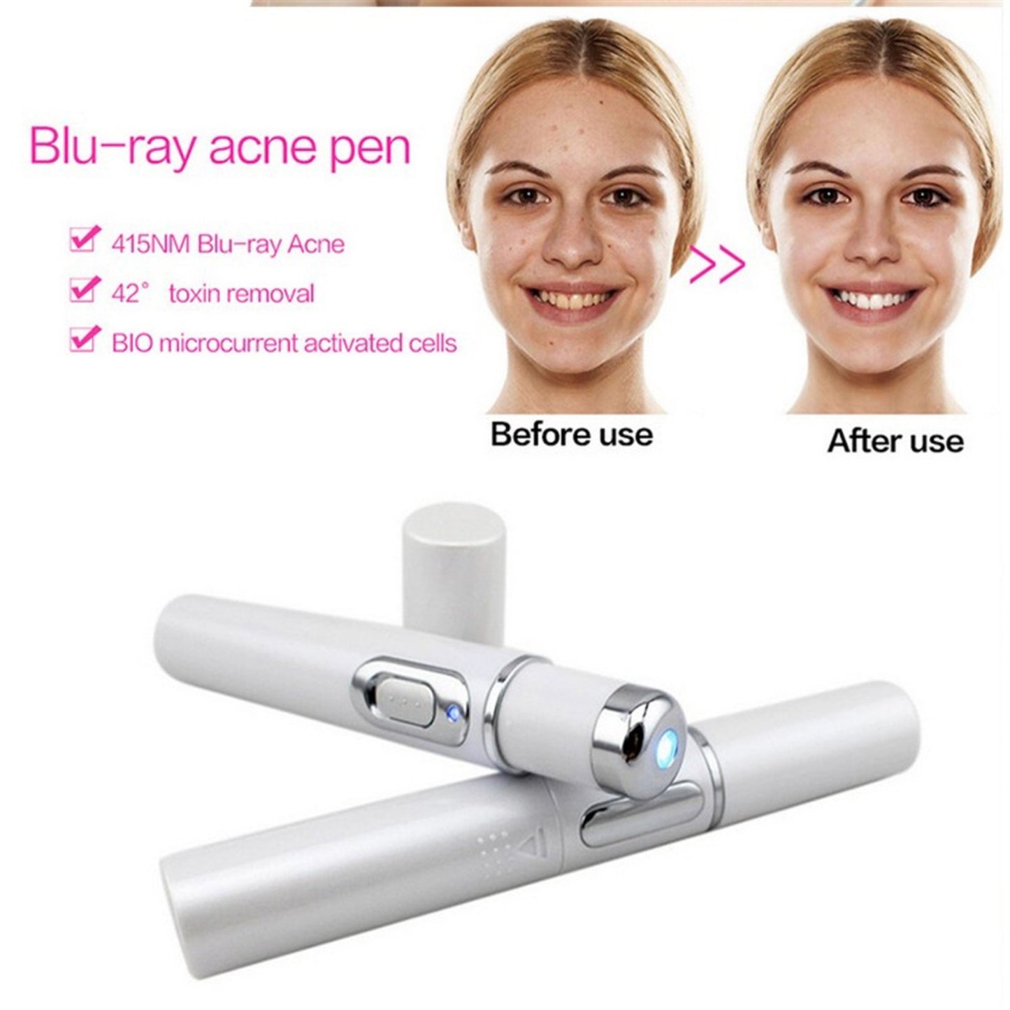 Blue Light Therapy Acne Laser Pen for Skin Care and Beauty Treatment