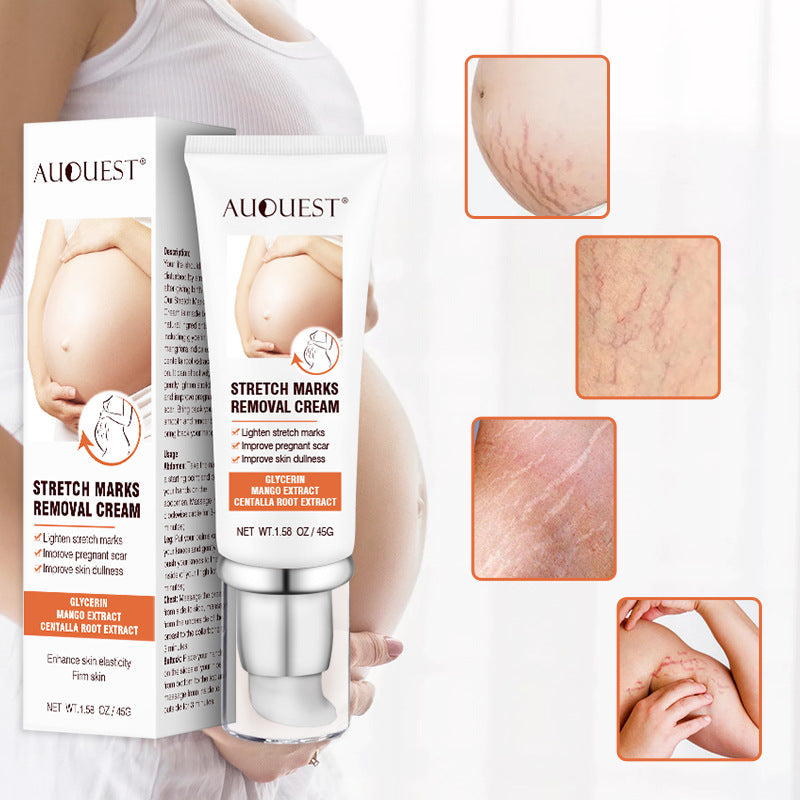 Remove Pregnancy Scars Acne Cream Stretch Mark Treatment Maternity