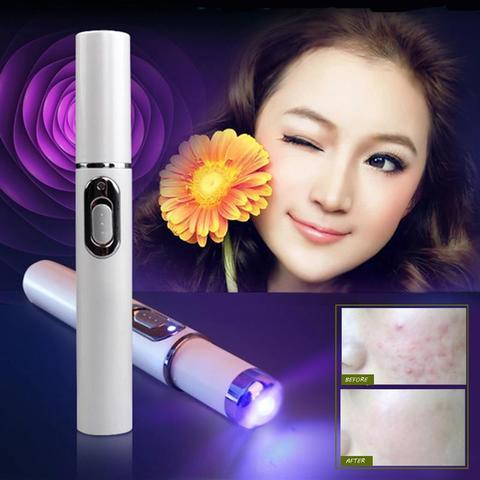 Blue Light Therapy Acne Laser Pen for Skin Care and Beauty Treatment