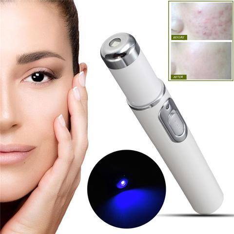 Blue Light Therapy Acne Laser Pen for Skin Care and Beauty Treatment